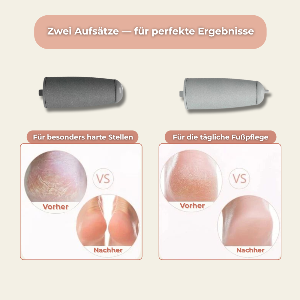 Veluxe PediPro - Elektischer Hornhautentferner